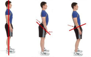 poorposture