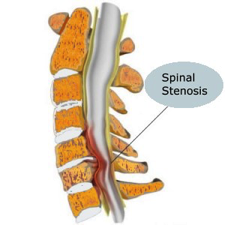spine