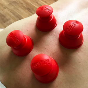 cupping