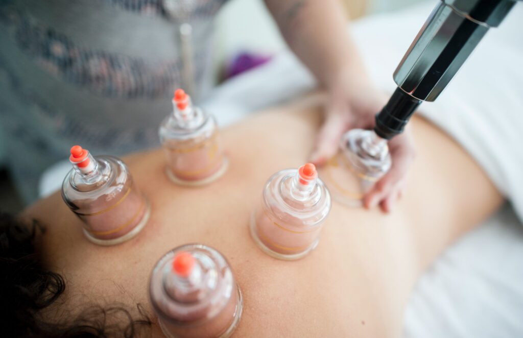 a woman getting botulas on her back